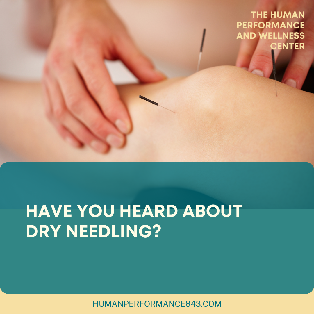 Discover the Benefits of Dry Needling in Physical Therapy